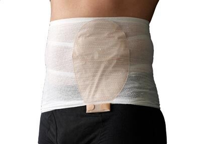 Stomasafe classic stomiposefiksering, medium 95-115cm