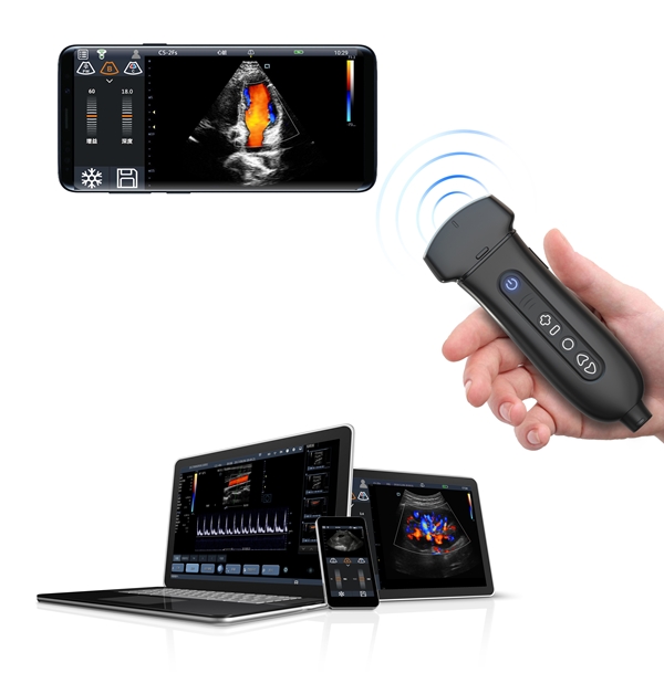 IQ-Q7 ultralydsscanner, inkl. 3 prober og tablet - 2