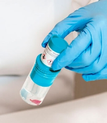 BiopSafe biopsi container