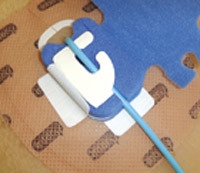 Skaterfix dreeni kiinnitysosa, 25KPL - Skaterfix