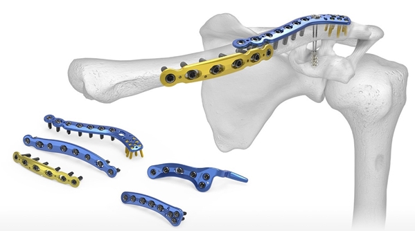 Acumed Clavicle Plating System | OneMed