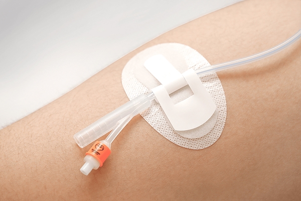 Kestokatetri 2-tie sil Nelaton, CH12 42cm bal. 5-10ml 10KPL - 4