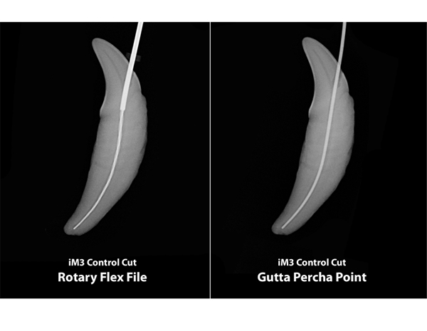 Control Cut Rotary Flex Files, 60mm ISO 070-140  8kpl setti - 4