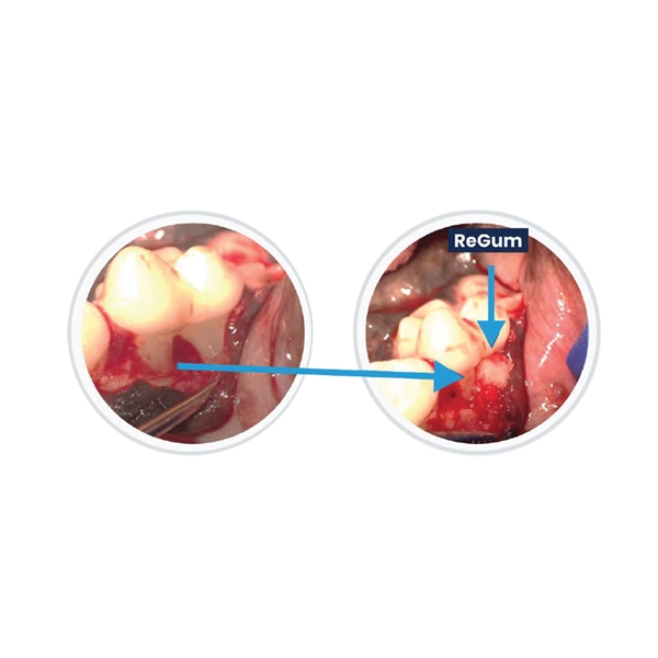 ReGum Vet Dental Implant, neliö 6kpl - 3