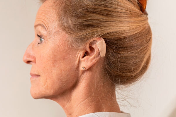 Haavasidos Mepilex Border Flex Lite, Lite, 7,5x7,5cm, 5kpl - Mepilex - 3