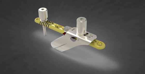 Acumed Osteotomy System | OneMed