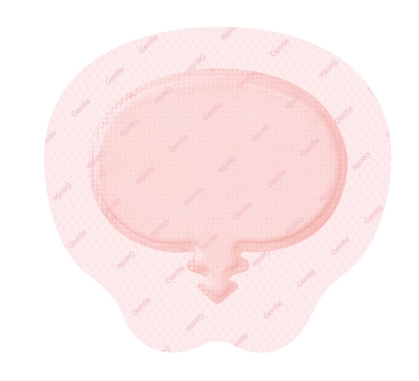 Haavasidos Allevyn Gentle, 16,8x17,1cm Border Sacrum 6KPL - Allevyn