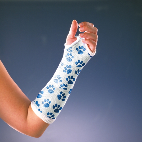 Kipsisidos Delta-Cast muovi, 7,5cmx3,6m tassukuvio 10KPL