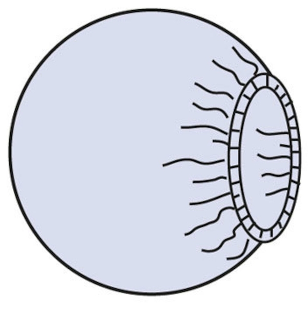 Laitesuoja evercare®, Halk 140cm pyöreä ster 40KPL - evercare®