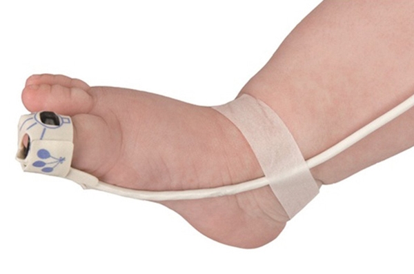 Nonin SpO2 Neo Replacement Wra, 25kpl Replacement Wraps