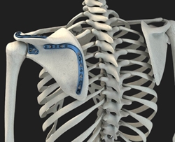 Acumed Scapula Plating System | OneMed