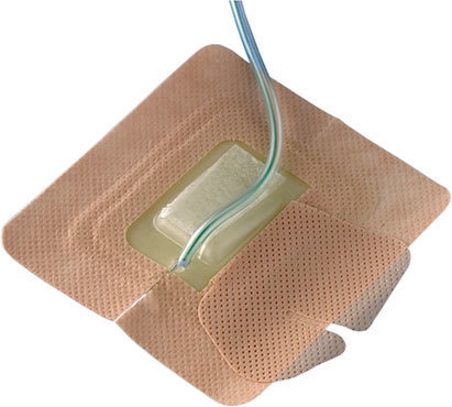 Drain-Fix Kateter fiksering CH12-22, CH 12-22 L 20-pack *B