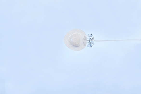 Neria Guard Infusjonssett , 60 cm, 6 mm - Neria Guard - 2