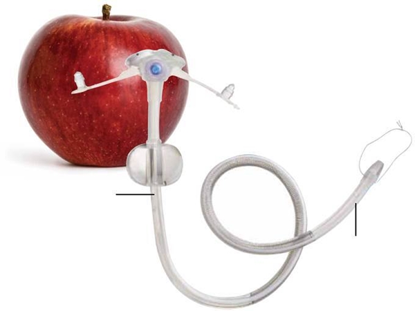 Ernæringssonde Transga Jejunal, G-Jet 14FR 2,5 cm 22cm