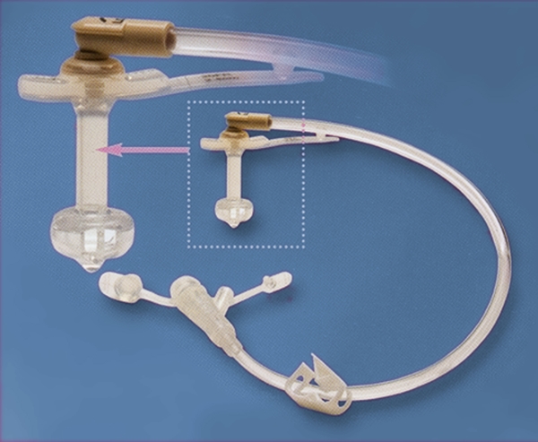 Gastrostomiport MiniONE, Non-Balloon Button 18F x 1,5cm