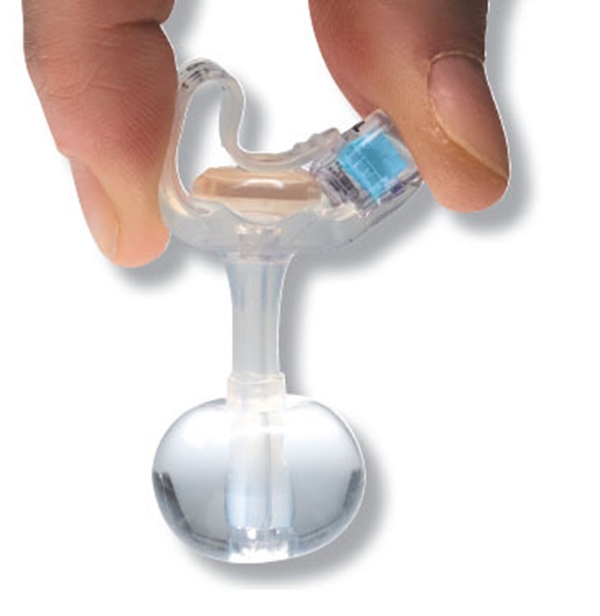 Gastrostomiport MiniONE Sett, 14Fr 4,0cm ENFit Sett