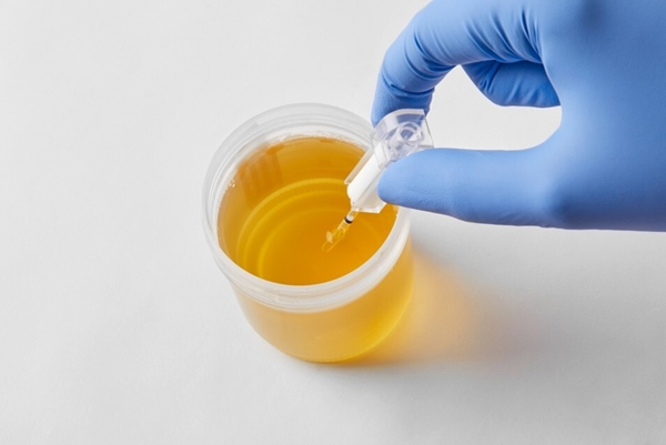 Test Mikroalbumin DCA2000, KJØLEVARE