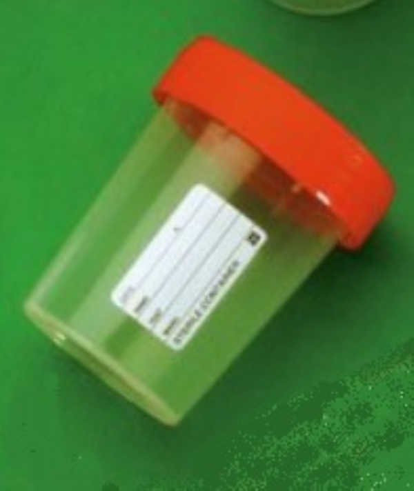 Urinprøveglass, 180ml
