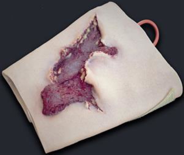 Sårskade ben, 1 stk refill Moulage Kit