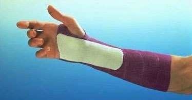 Gips syntetisk 3M Scotchcast
 , 10cmx0,9m Longuette - Scotchcast