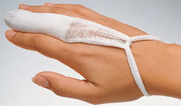 Fingerförband tubgas tg fix, medium - TG