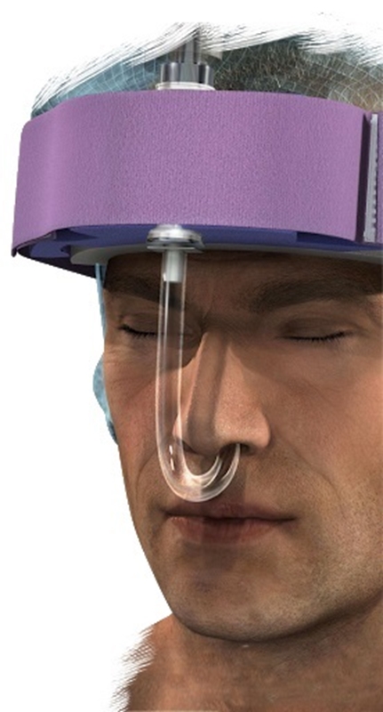 Endotrakealtubhållare DermaProx, f nasal tub - 2