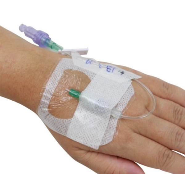 Venkateterförband Tegaderm IV Advanced, 6,5x7cm slits förstärkt - Tegaderm - 1