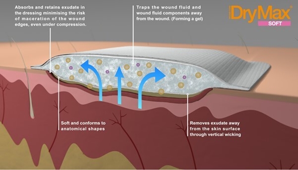 Superabsorberande förband DryMax Soft, 10x20cm - DryMax - 3