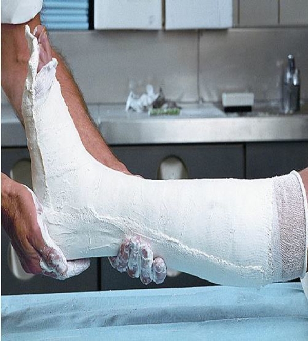 Gipsskena kalk Cellona Xtra, 10cm x 20m 4L - Cellona