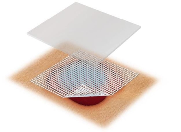 Salvkompress Lomatuell Pro, 10x20cm - Lomatuell