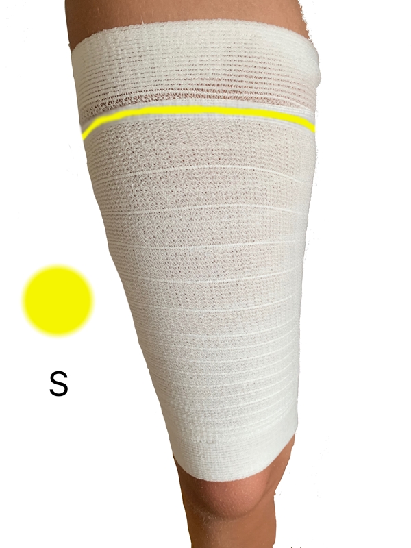 Benfixering urinpåse LegFix, S 24-39cm gul - ProSense