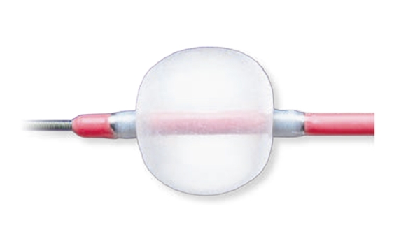 Kateter embolektomi, 4fr 80cm dubbellumen