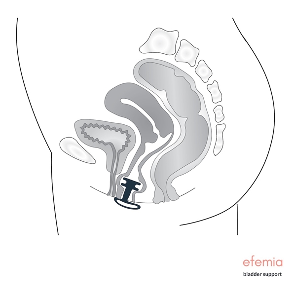 Kontinensstöd flergångs Efemia, 35mm silikon M - 2