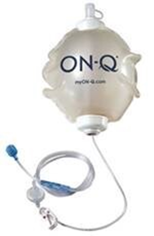 Pain Relief Pump 270ml, 4ml/h