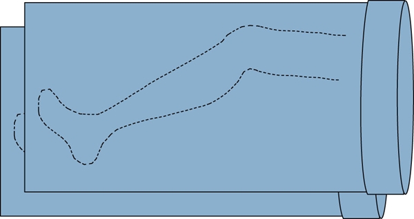 Op skydd benstrumpa Barrier, 75x120cm 2st - Barrier