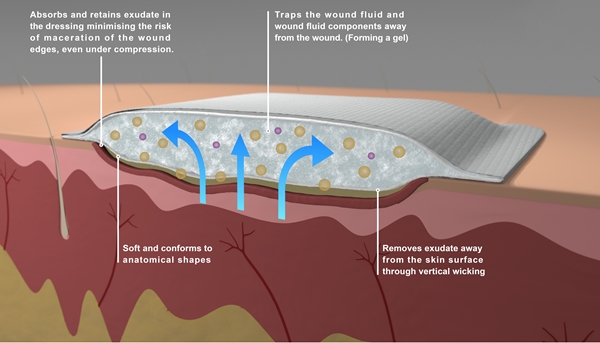 Skumförband DryMax Foam, 7,5x7,5cm - Super Foam - 3
