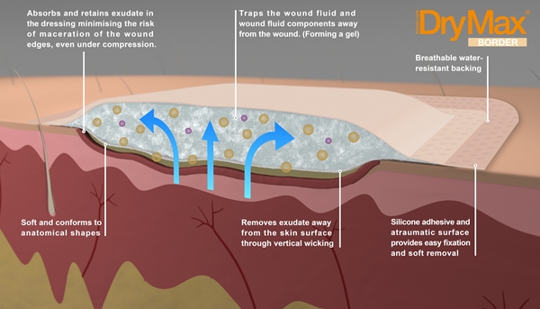 Superabsorberande förband DryMax, 10x10cm silikon Border - DryMax - 2