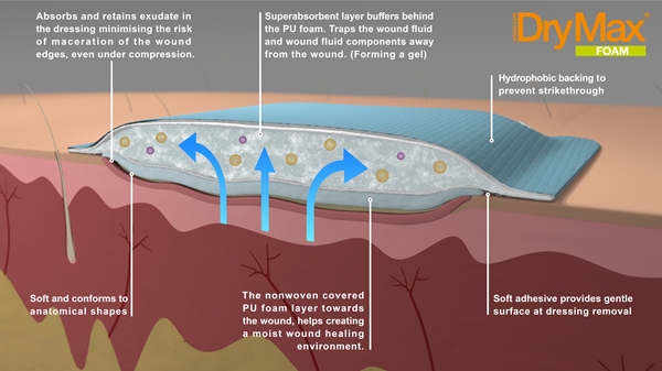Superabsorberande förband DryMax, 37x56cm 10-p osteril - DryMax - 2