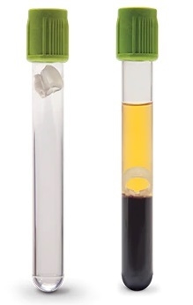 Vakuumrör BD Vacutainer Barricor , 5/3ml Li-Heparin separator grön