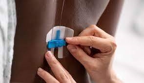 Fixering epidural FlexGrip, 20-16G - FlexGrip - 2