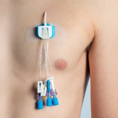 Fixering CVK Bedal, t CVK/PICC - bedal