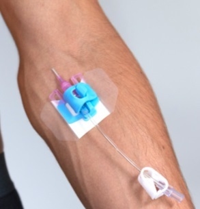 Fixering PVK Bedal, t katetrar m luerlock