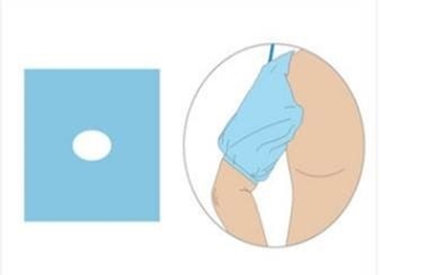 Elastisk vätskebarriär, ben