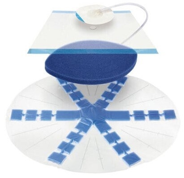 Undertryck Förbandskit Abthera VAC, bukförband Foam Film koppling - VAC