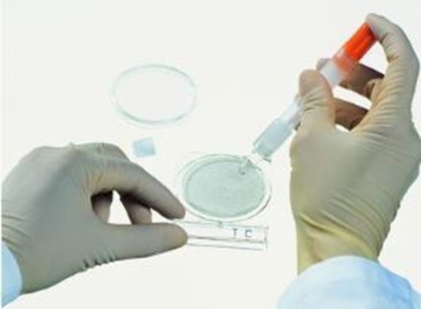 Agarplatta TC total count, Compact Dry