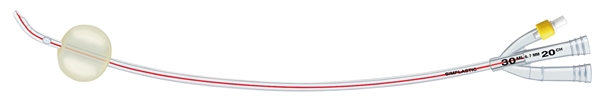 Kateter 3-vägs hematuri Softsimplastic, 30ml ch22 40cm Dufour - Simplastic