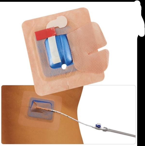 Fixeringsförband för dränage StayFix, 15-24Fr Large 10x9cm - Stayfix