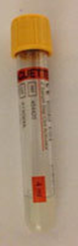 Vakuumrör VACUETTE transparent etikett, 5/3,5ml serum gel guldgul