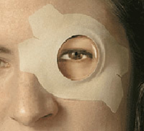 Ögonskydd ProOphta S, small häftande med lins - Pro-Ophta