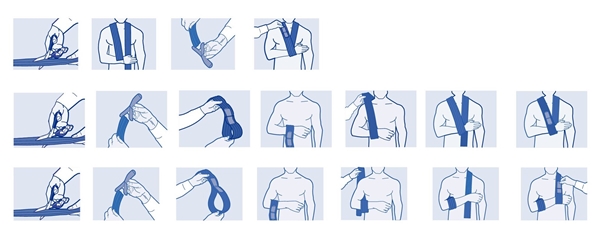 Armslinga Actimove Sling, 5cmx12mx2 + 20 kardb.fästen - Actimove - 3